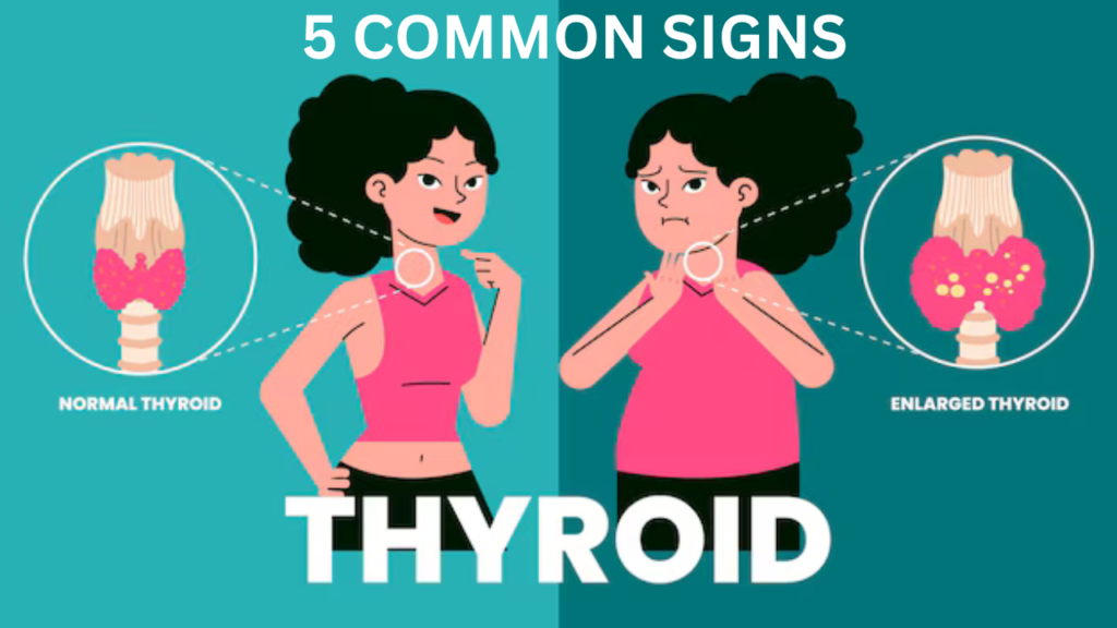 5 COMMON SIGNS THYROID